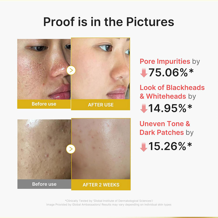 پیلینگ شات کوجیک اسید و زردچوبه روشن کننده و لایه بردار صورت مدی کیوب MEDICUBE Kojic Acid Turmeric Peel Shot
